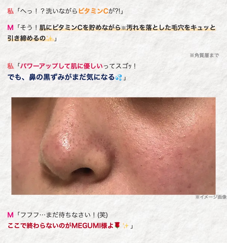 私 「へっ!? 洗いながらビタミンCが?!」
M 「そう!肌にビタミンCを貯めながら汚れを落とした毛穴をキュッと
引き締めるの」
私 「パワーアップして肌に優しいってスゴッ!
でも、鼻の黒ずみがまだ気になる」
M 「フフフ･･･まだ待ちなさい! (笑)
ここで終わらないのがMEGUMI様よ」
※角質層まで
※イメージ画像